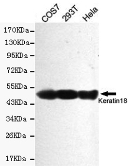 Keratin 18 Monoclonal Antibody