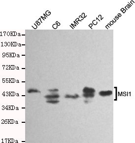 Musashi-1 Monoclonal Antibody