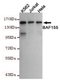 SMARCC1 Monoclonal Antibody