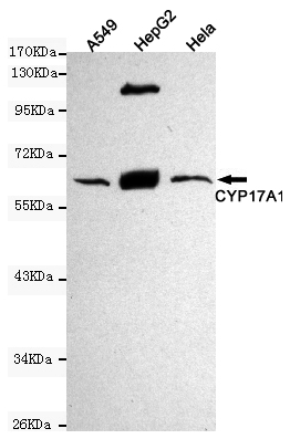 Cytochrome P450 17A1 Monoclonal Antibody