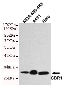 CBR1 Monoclonal Antibody