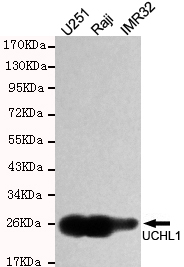 UCHL1/PGP9.5 Monoclonal Antibody