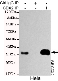 CDX2 Monoclonal Antibody