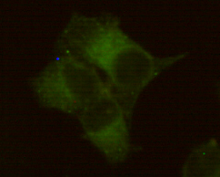 Placental alkaline phosphatase (PLAP) Monoclonal Antibody