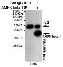 AMPK beta 1 Monoclonal Antibody