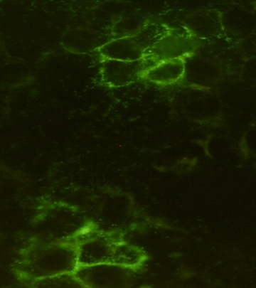 Noggin Monoclonal Antibody