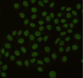 PCNA Monoclonal Antibody