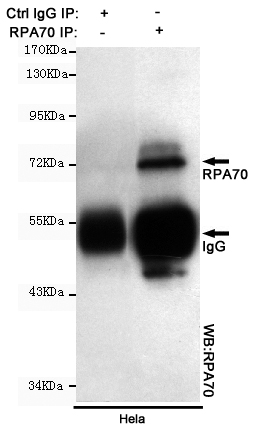 RPA70 Monoclonal Antibody