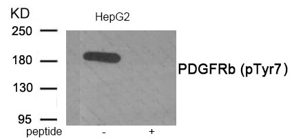 PDGFRb (Phospho-Tyr771) Antibody