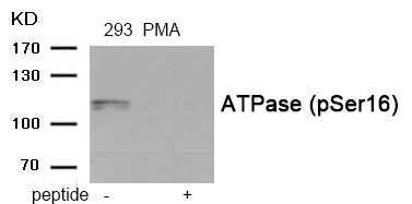 ATPase (Phospho-Ser16) Antibody