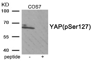 YAP (Phospho-Ser127) Antibody