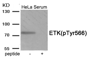 ETK (Phospho-Tyr566) Antibody