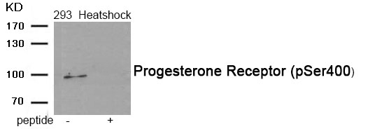 Progesterone Receptor (Phospho-Ser400) Antibody