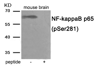 NF- kappaB p65 (Phospho-Ser281) Antibody