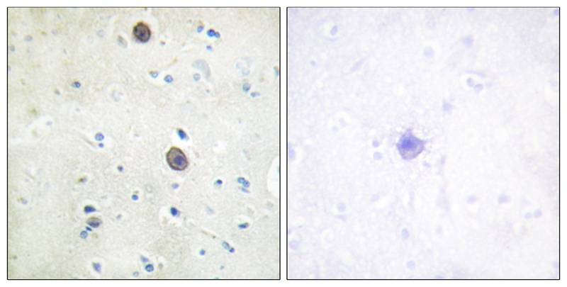 Amyloid β A4 (Phospho-Thr743/668) Antibody