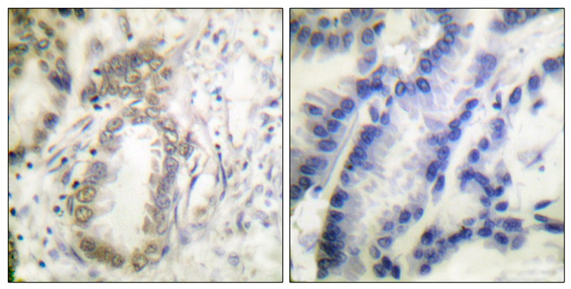 C/EBP-α (Phospho-Ser21) Antibody