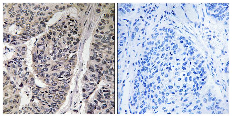 p130 Cas (Phospho-Tyr410) Antibody