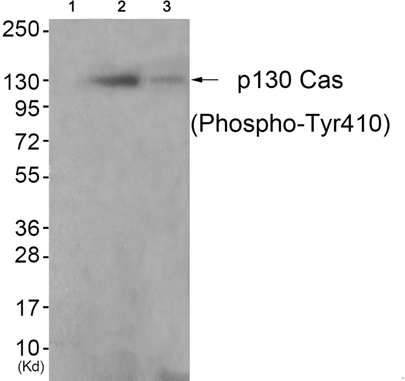 p130 Cas (Phospho-Tyr410) Antibody