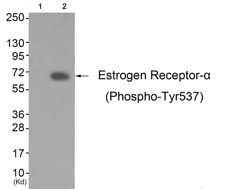 Estrogen Receptor-α (Phospho-Tyr537) Antibody