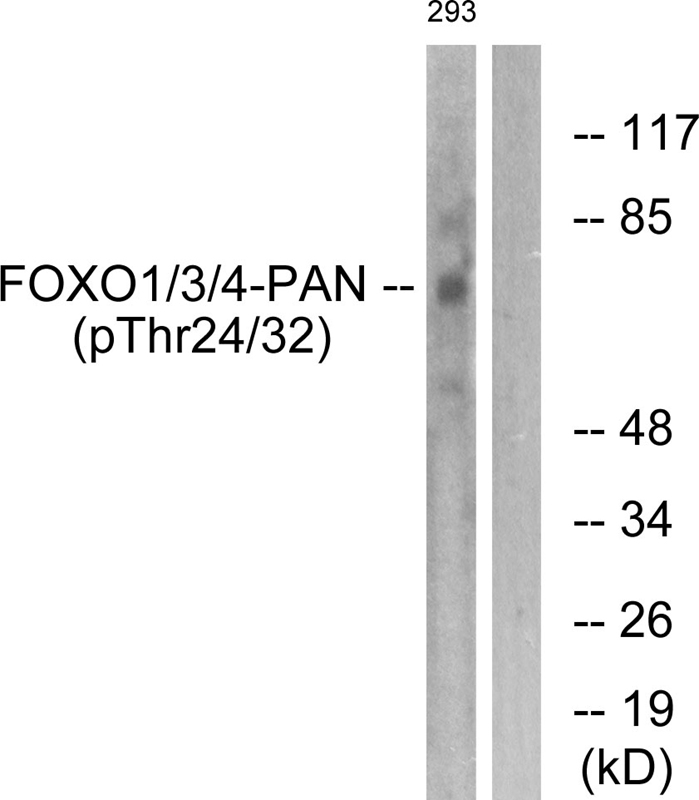 FOXO1/3/4-pan (Phospho-Thr24/32) Antibody