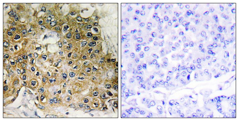 Integrin β1 (Phospho-Thr789) Antibody