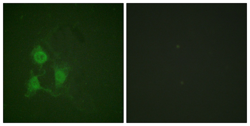 PKA α/β CAT (Phospho-Thr197) Antibody