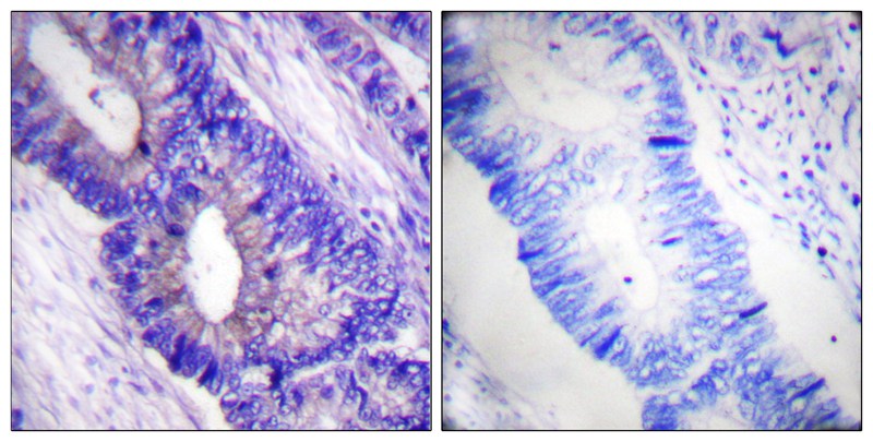 PKA α/β CAT (Phospho-Thr197) Antibody