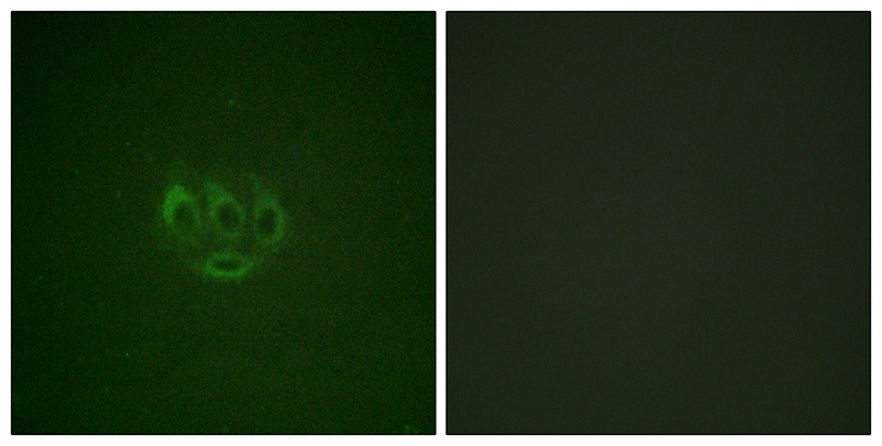 ACK1 (Phospho-Tyr284) Antibody