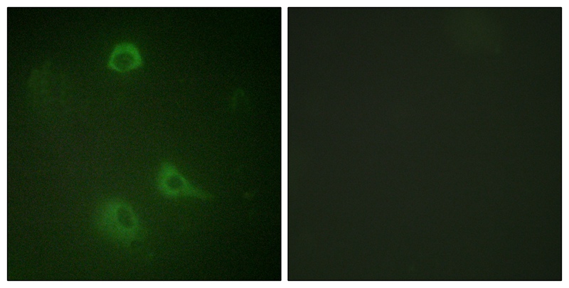 NMDAR1 (Phospho-Ser890) Antibody