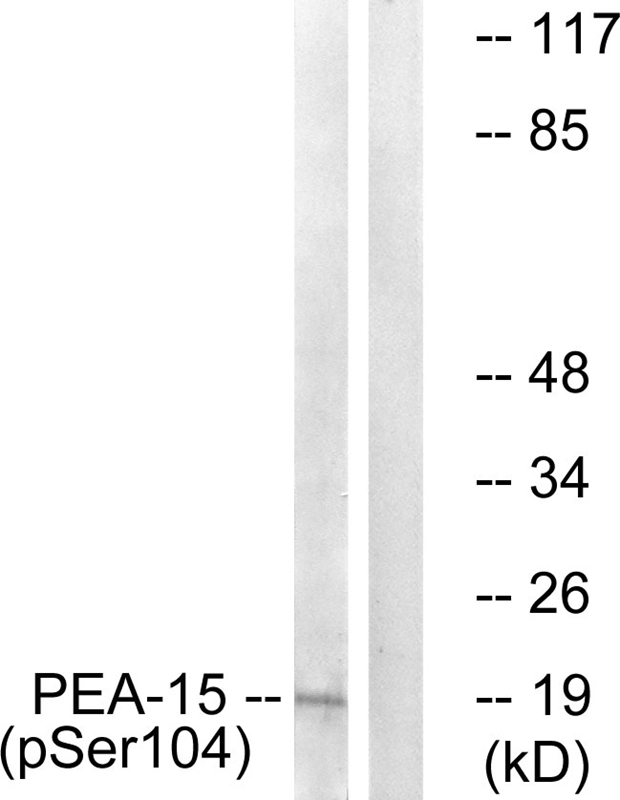 PEA-15 (Phospho-Ser104) Antibody