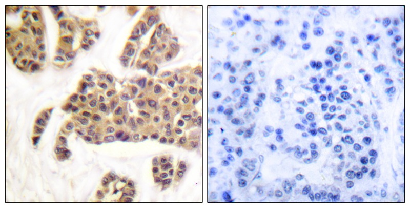 BAD (Phospho-Ser91/128) Antibody