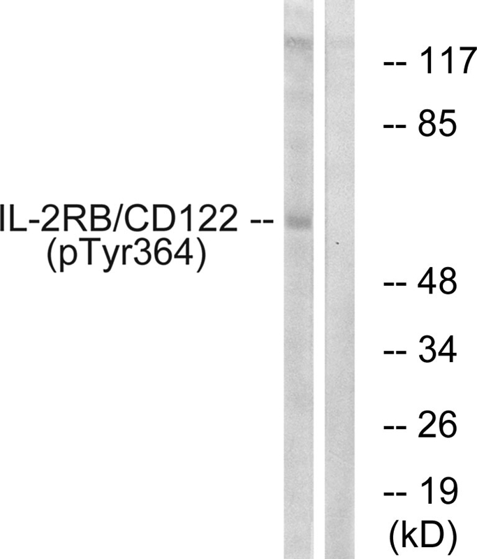 IL-2Rβ/CD122 (Phospho-Tyr364) Antibody