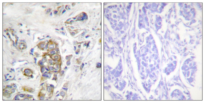 ITGB4 (Phospho-Tyr1510) Antibody