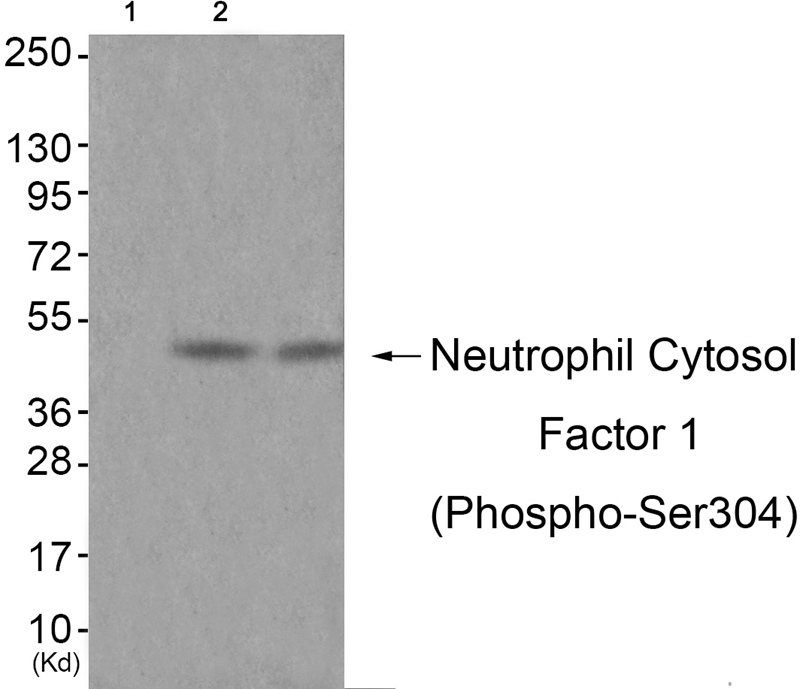 Neutrophil Cytosol Factor 1 (Phospho-Ser304) Antibody