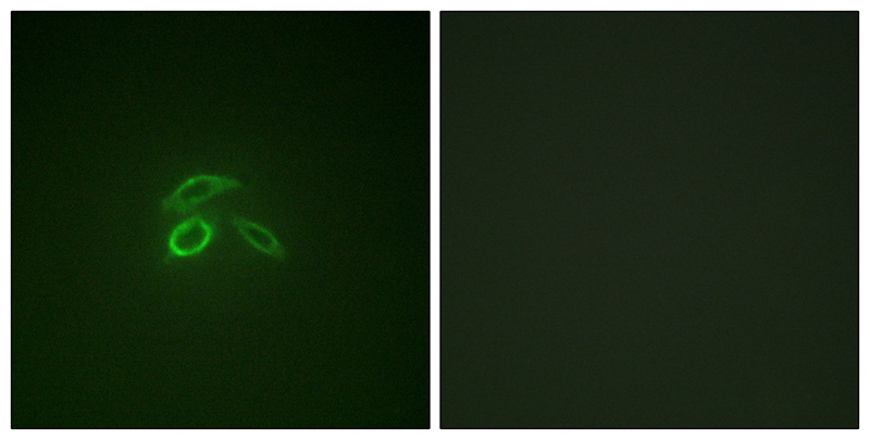 CD227/MUC1 (Phospho-Tyr1229) Antibody