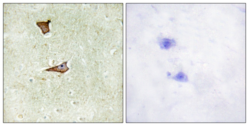 IGF2R (Phospho-Ser2409) Antibody