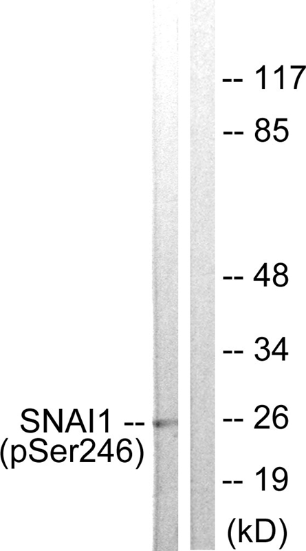 SNAI1 (Phospho-Ser246) Antibody