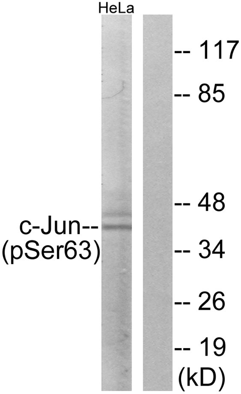 c-Jun (Phospho-Ser63) Antibody