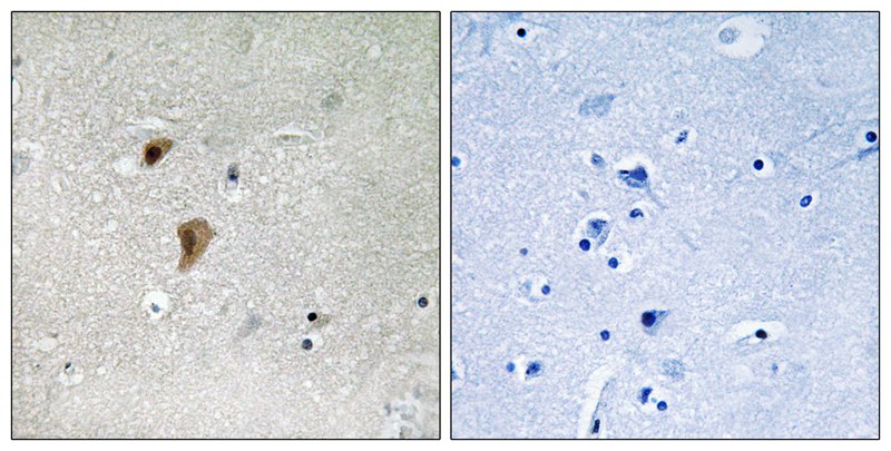 HSF1 (Phospho-Thr142) Antibody