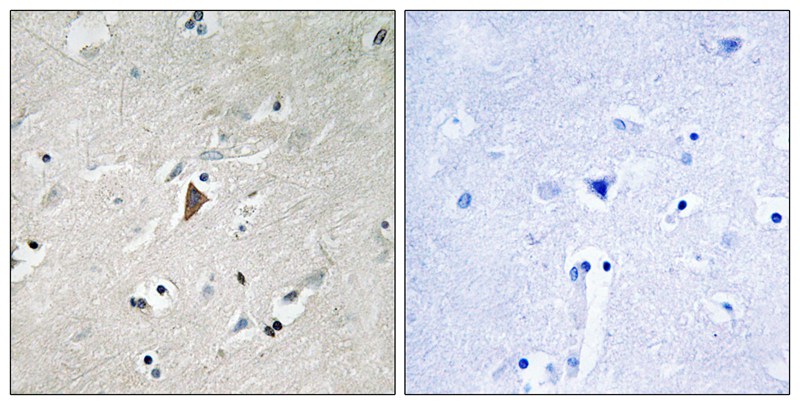 PDK1 (Phospho-Tyr9) Antibody