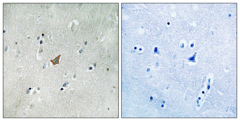 EPHA3/4/5 (Phospho-Tyr779/833) Antibody