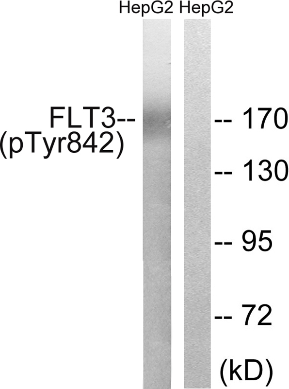 FLT3 (Phospho-Tyr842) Antibody