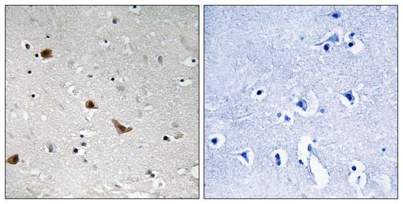 IKK-γ (Phospho-Ser376) Antibody