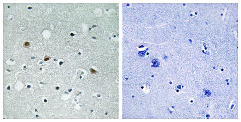 LATS1/2 (Phospho-Thr1079/1041) Antibody