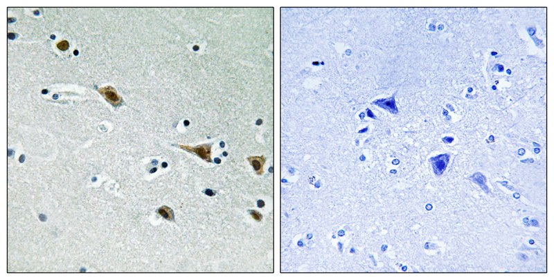 MAP2K7 (Phospho-Ser271) Antibody