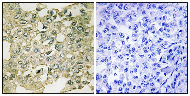 MYT1 (Phospho-Ser83) Antibody