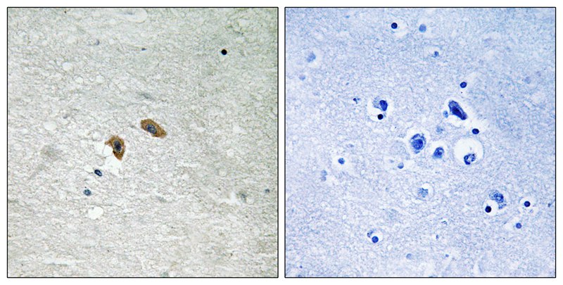 C-RAF (Phospho-Thr269) Antibody