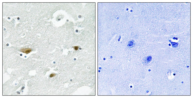 STK39 (Phospho-Ser323) Antibody