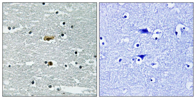 STK39 (Phospho-Ser309) Antibody