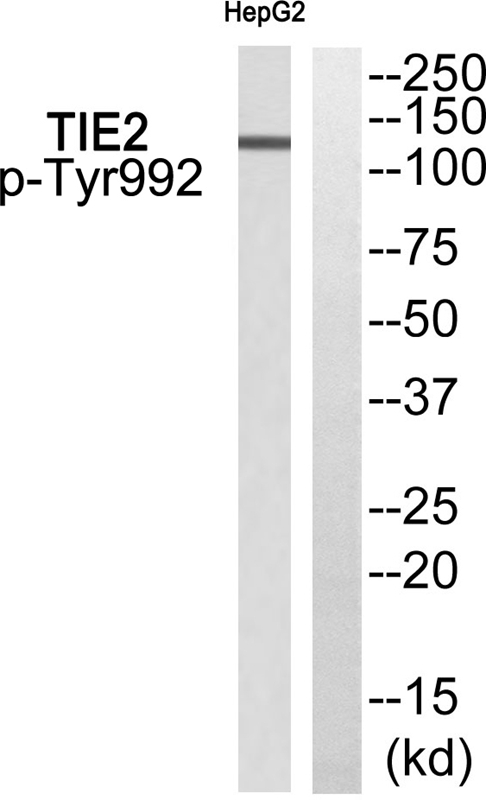 TIE2 (Phospho-Tyr992) Antibody